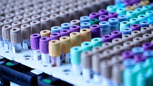 Contrinex photoelectrics detect blood vials