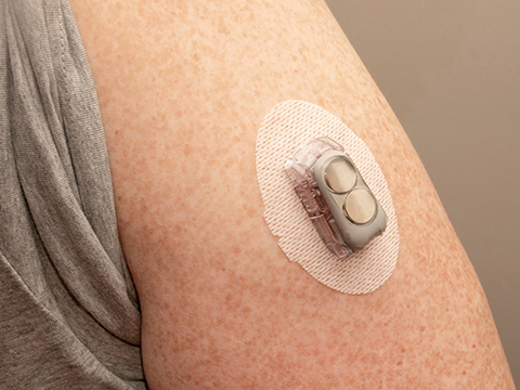 New guide explores wearable Medtech adhesives