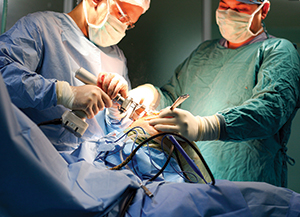 Driving up performance in surgical hand tools