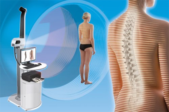 Optical spine and posture analysis with uEye industrial cameras