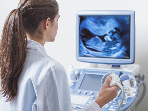 Looking beyond the surface – motors enabling medical imaging
